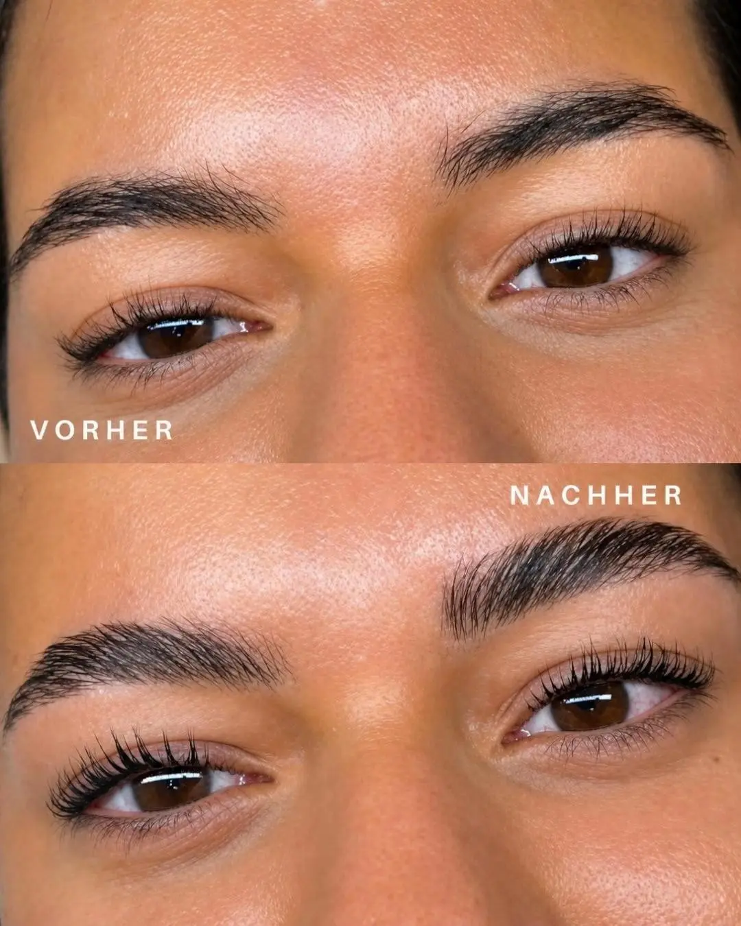 Vorher-nachher-Vergleich der Augenbrauen: oben wachsen die Härchen ungeordnet und flach, unten stehen sie gleichmäßig aufgerichtet in einer klaren Schwingung